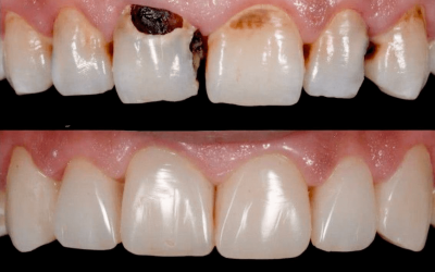 ODONTOLOGÍA CONSERVADORA