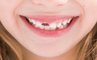 ODONTOPEDIATRÍA ODONTOPEDIATRÍA