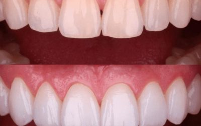 Portada Estetica dental